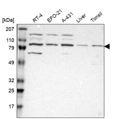 Kaiso Antibody, Novus Biologicals 0.1mL; Unlabeled:Antibodies, Polyclonal